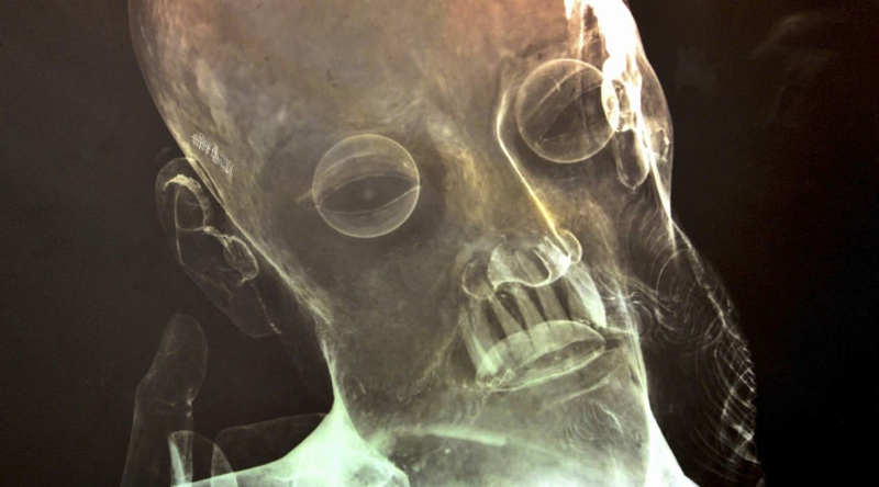 Illustration for article titled X-Ray Reveals Real Human Teeth in 300-Year-Old Jesus Statue